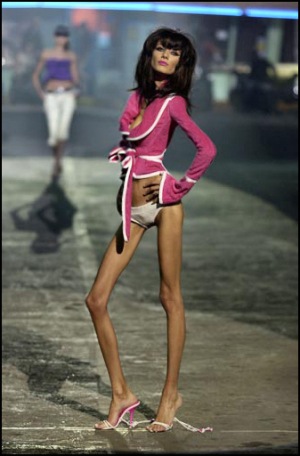 anorexic person in world. person or organization,